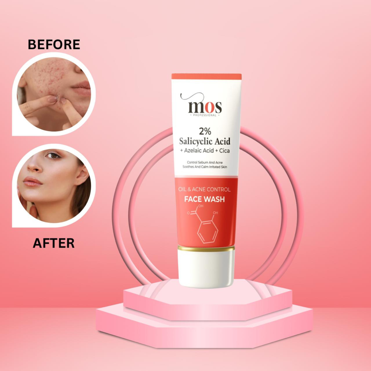 Oil & Acne Control Facewash 100ml